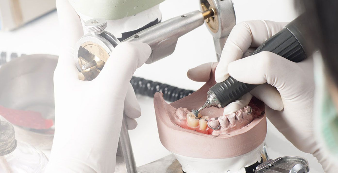 Modelieren einer Zahnprothese